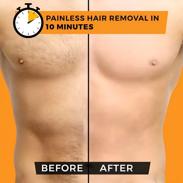 Chirs’s Hair Removal Spray for Men
